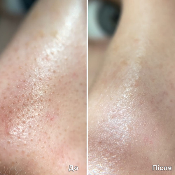 Detox Peeling Mask Очищуюча крем-маска з ефектом пілінгу